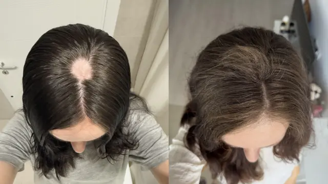 два фото - на одному фото залисина в дівчини посередині проділу, на іншому - ні