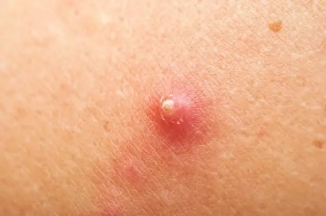 બીબીસી ગુજરાતી, ગુજરાત, બીબીસી, અમદાવાદ, બોલીવૂડ, હેલ્થ, સ્વાસ્થ્ય