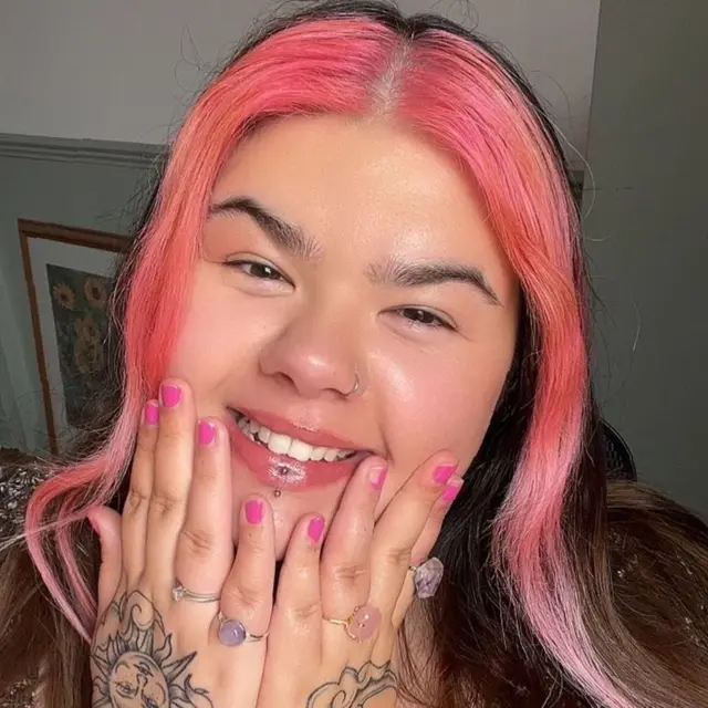 માઇગ્રેન કેવી રીતે થાય, માઇગ્રેનથી કેવી રીતે રાહ મળે, કોલા અને ફ્રાઇથી માઇગ્રેનમાં રાહત મળે, બીબીસી ગુજરાતી આંતરરાષ્ટ્રીય સમાચાર