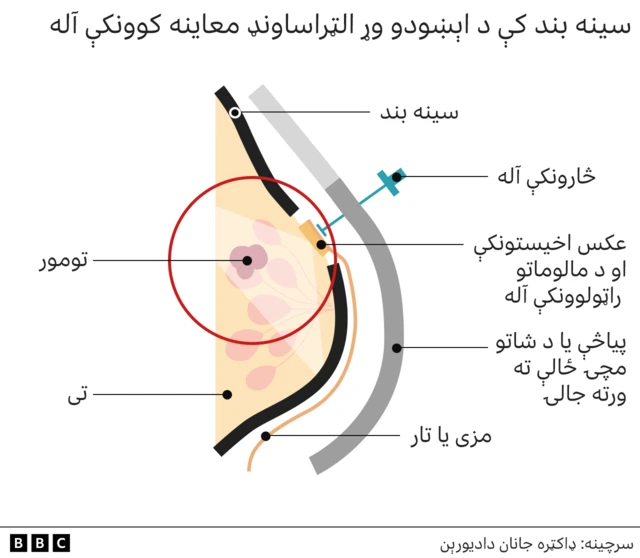 A graphic showing how the ultrasound device works