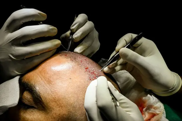 Tima beerashada ayaa soo caan baxday tobanki sano e u dambeysay