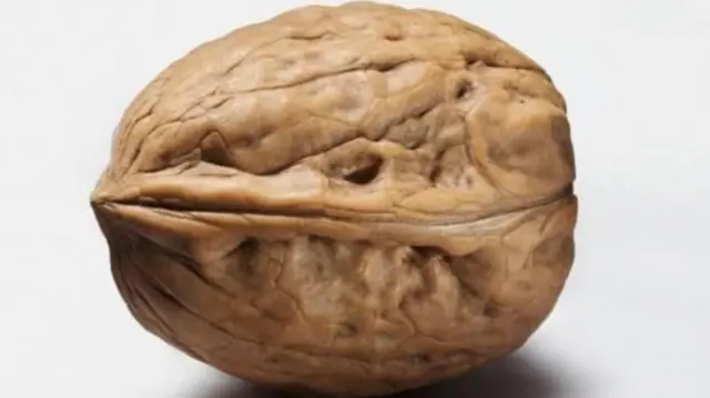 ప్రోస్టేట్ అనేది ఒక చిన్న గ్రంథి