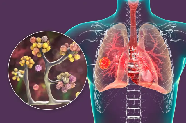 ఊపిరితిత్తులు