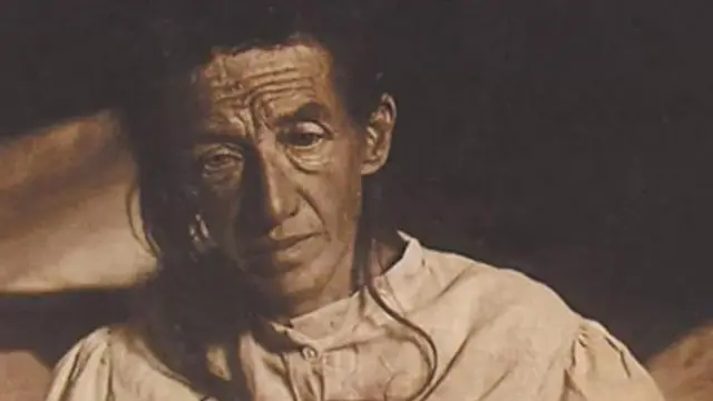 Mwanzoni mwa miaka ya 1900, Alzheimer"alipata wazo kwamba magonjwa ya akili yalikuwa magonjwa kama magonjwa mengine