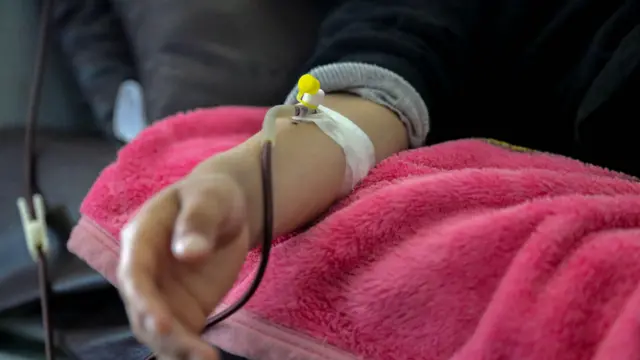 प्रातिनिधिक