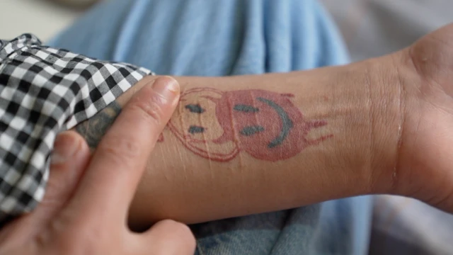 هلما می‌گوید در پی فشارهای روانی زندان چندین بار اقدام به خودکشی کرده است. او اما برای فراموش کردن «آسیبی که به خودش زده» روی جای زخم‌هایش را تتو کرده است