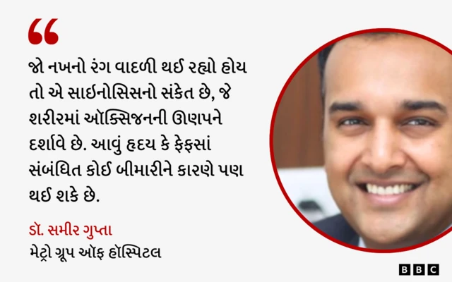 નખ, સ્વાસ્થ્ય, બીમારી, રોગ, હૅલ્થ, બીબીસી ગુજરાતી 