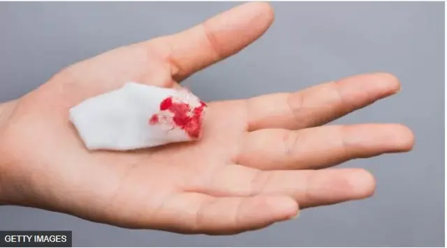 Pépà tó ń ṣàfihàn ẹ̀jẹ̀ 