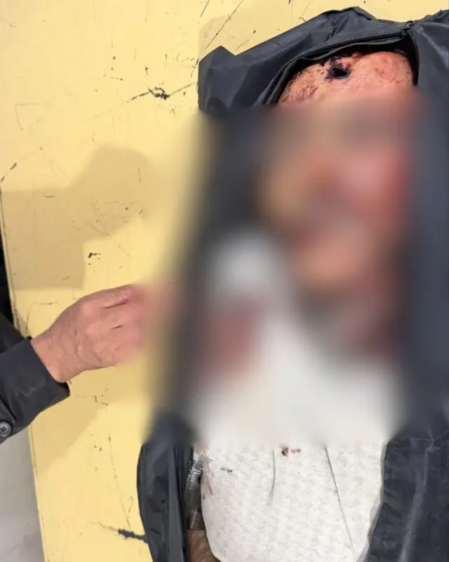 پیکر ابراهیم پوراحمدیان در سردخانه 