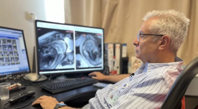 Profesör Chen Hoffman ülkenin en önemli birkaç fetal radyoloji uzmanından biri 