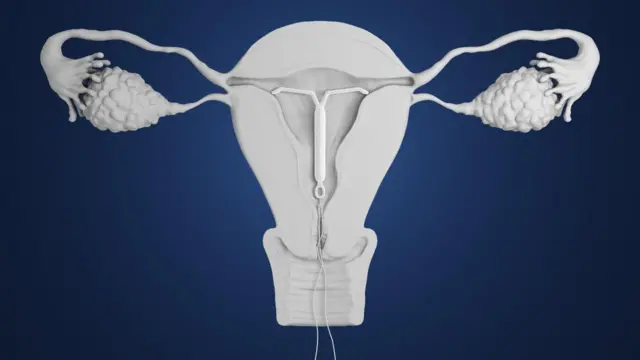 خاندانی منصوبہ بندی