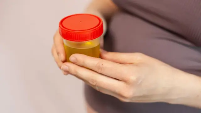 امرأة تحمل عينة من البول