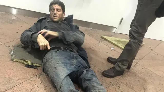 وقتی این عکس گرفته شد، پاهای بلین به شدت خونریزی داشت