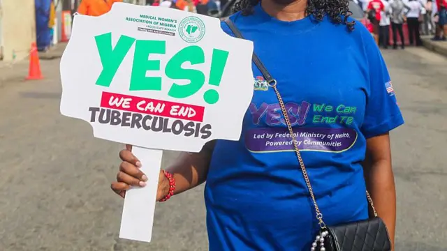Nwaanyị ji akwụkwọ ji akwụkwọ na-egosi ije ha mere megide ọrịa Tuberculosis