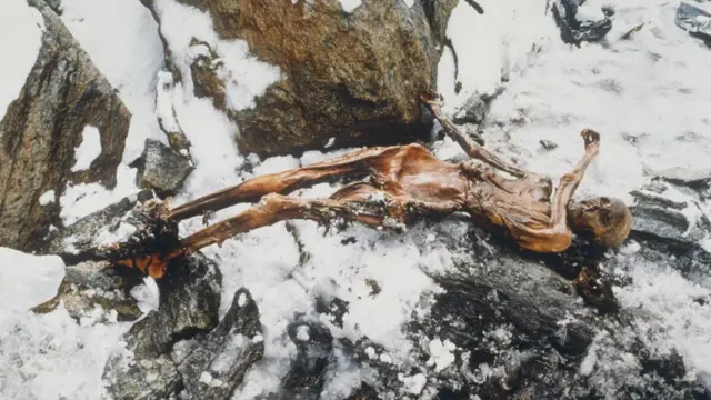 Otzi