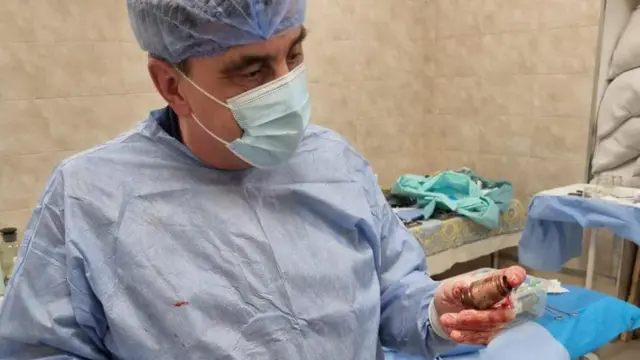 शल्यक्रियापछि निकालिएको ग्रिनेड हेर्दै डा. भर्बा