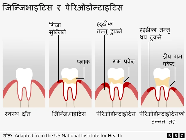 दन्त स्वास्थ्य