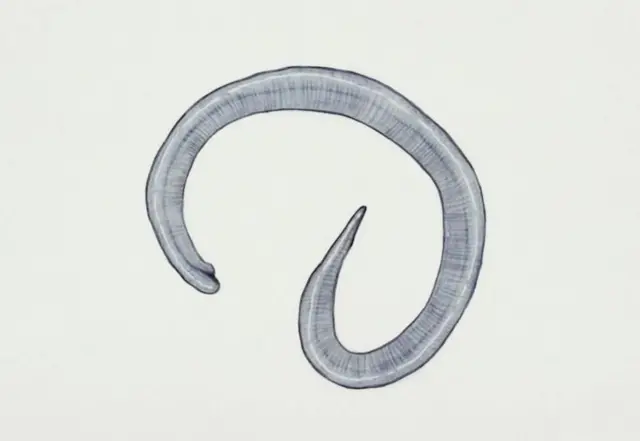 બાળકના આંતરડાંમાં કૃમિ થાય તો શું કરવું અને એનાથી બચવું કઈ રીતે?