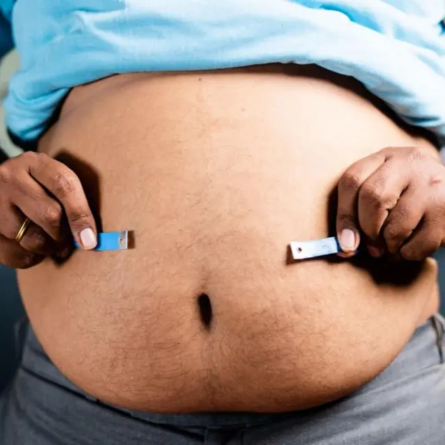 वजन कमी करण्याचा निर्णय घेण्याआधी डॉक्टरांचं मार्गदर्शन घ्या