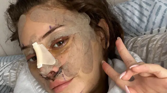 Fotografia o înfățișează pe Emily după operație. Ea are plasturi pe frunte și pe obraji, precum și pe nas. Ea ține două degete în semn de V către aparatul foto, în timp ce stă întinsă pe un pat.