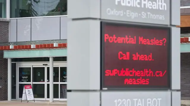 কানাডার একটি হাসপাতালে ইলেকট্রনিক বিলবোর্ডে হাম সংক্রমণ নিয়ে যোগাযোগের ওয়েবসাইটের ঠিকানা দেখানো হচ্ছে 