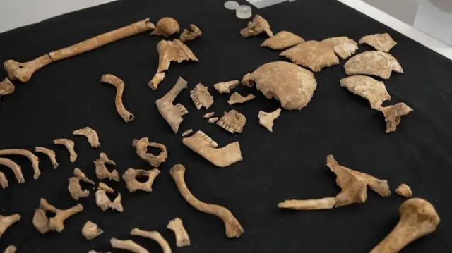 Restos hallados en el cementerio medieval 