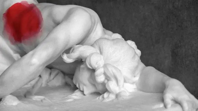 ਐਂਡੋਮੇਟ੍ਰੀਓਸਿਸ