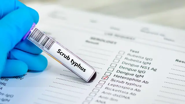 పురుగు, ఓరియంటియా సుట్సుగముషి