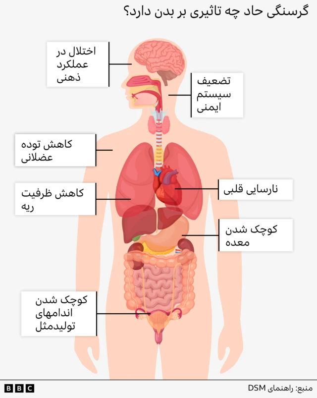 اثرات بلندمدت گرسنگی بر بدن، تصویرسازی از درون بدن انسان