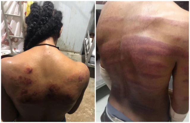 ኣብቲ መዓስከር ማእሰርትን መግረፍትን ዝወረዶም ኢትዮጵያውያን