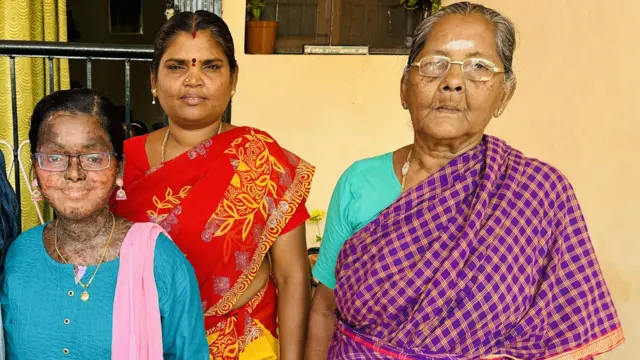 மதுரை, பார்கவி