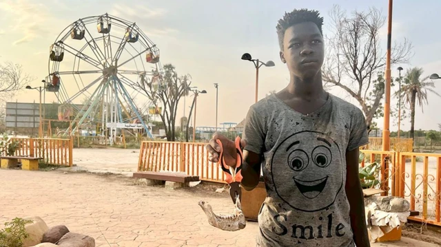 لم تستطع أن تنقذهما معا.. أم سودانية تضطر للاختيار بين علاج طفلتيها التوأم