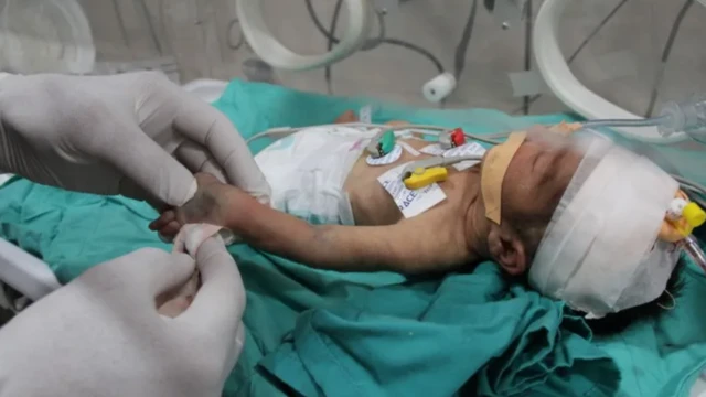 लहान बाळ 