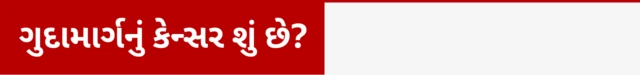 ગુદામાગ્રનું કૅન્સર, બીબીસી ગુજરાતી