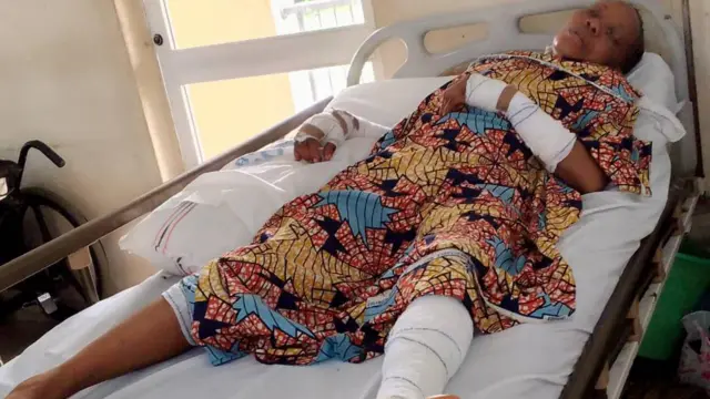 Di ya jikwa mma gbukasịa ya ahụ ka ọ rụkpọchara ya anya.