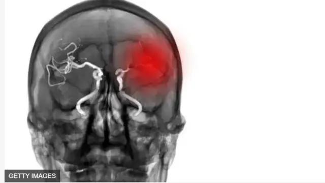 Aworan inu ori eeyan