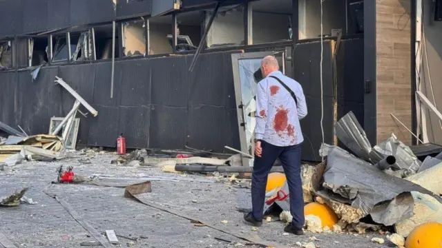 Чоловік у закривавленій сорочці йде понищеною вулицею