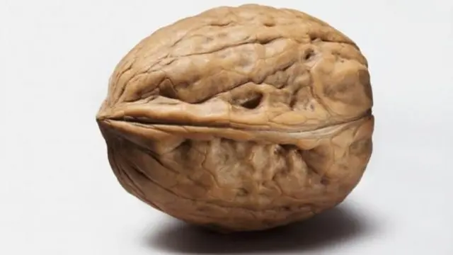 प्रोस्टेट काय आहे?