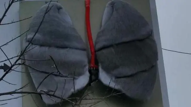 दुई वर्षअघि स्वास्थ्य मन्त्रालयको मूलद्वारनजिकै राखिएको कृत्रिम फोक्सो