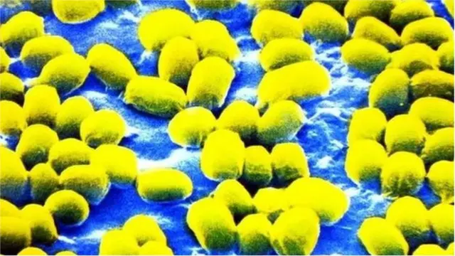 Dem burn cows wey dem confam say get Anthrax disease