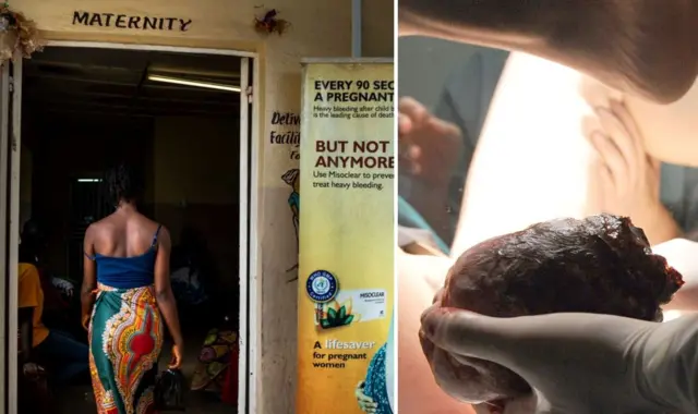 Aworan ibi ọmọ ati ile iwosan