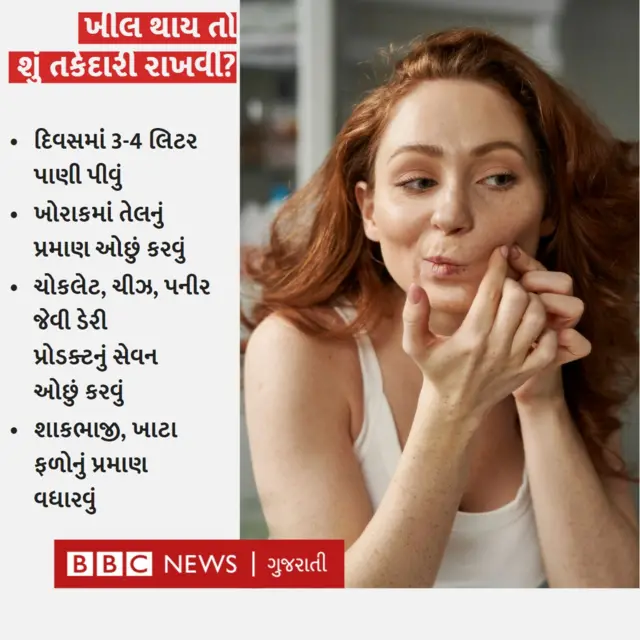 ખીલ, ચહેરા પરની ખીલ, ખીલનાં લક્ષણો, ખીલની સારવાર, બીબીસી ગુજરાતી
