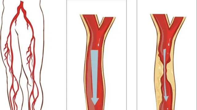 రక్తసరఫరా వ్యవస్థ