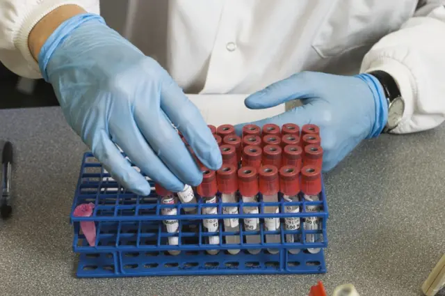 ਸੰਕੇਤਕ ਤਸਵੀਰ