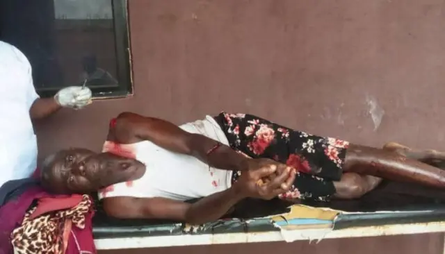 Aworan ọkan lara ọmọ ogun Amoyekun to farapa