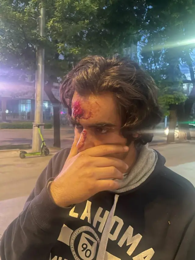 স্থানীয়দের হামলার শিকার হওয়া কিরগিস্তানে অধ্যয়নরত এক শিক্ষার্থী।