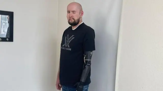 అవయవమార్పిడి చికిత్స