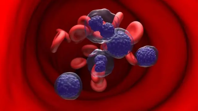 प्रातिनिधिक छायाचित्र
