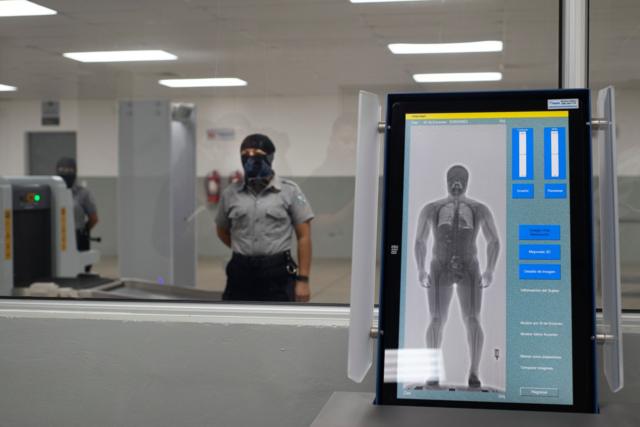 Una pantalla de rayos X revela los órganos de un preso