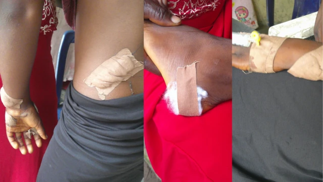 Ejima Felicia kọrọ na nwoke ahụ weere mma o ji n'aka gbuo nwanne ya n'ikiri ụkwụ mgbe ọ nwara ịgba ọsọ, ma malite gbuwezie ya mma ahụ n'ebe ndị ọzọ.